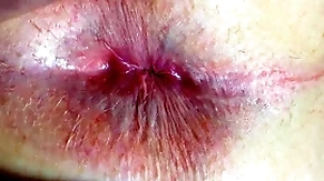 Nuisance increased by anus closeup